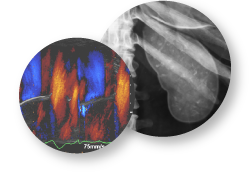 Findings from CRIC are represented in manuscripts and abstracts